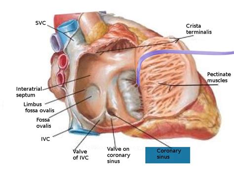 Anatomy, Thorax, Coronary Sinus Article