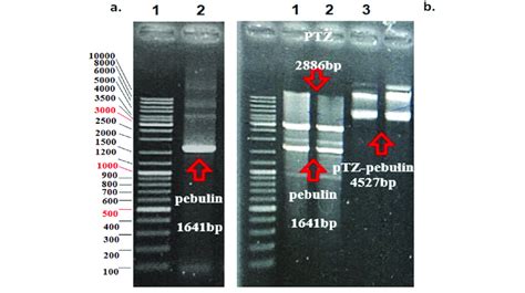 (a) PCR product of pebulin gene. Lane 1: GeneRuler 1 kb DNA Ladder... | Download Scientific Diagram