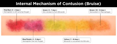 101 Series: The Colorful Stages of Skin Bruising – Food for Skin