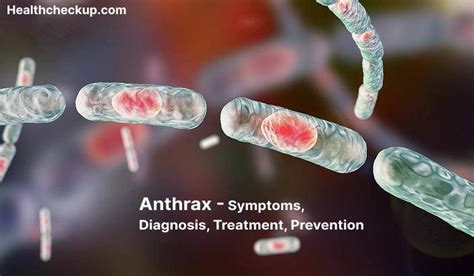 Anthrax -Symptoms, Diagnosis, Treatment, Prevention