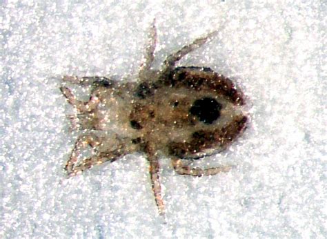 25 Lovely Tiny Mites On Skin - Demodectic Mange