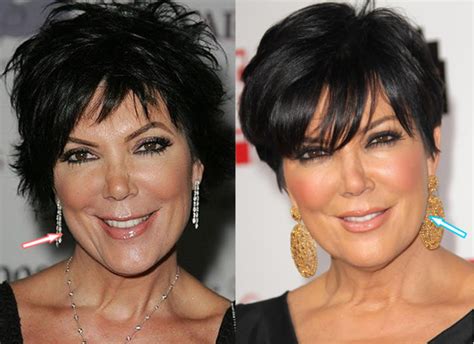 Kris Jenner Before And After – Telegraph