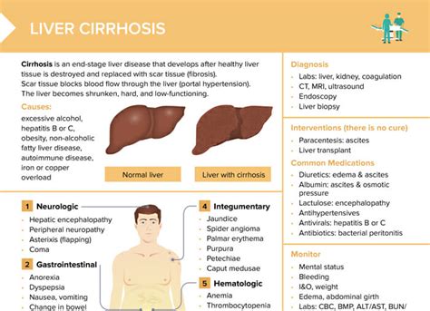 Liver Cirrhosis [+ Free Cheat Sheet] | Lecturio Nursing