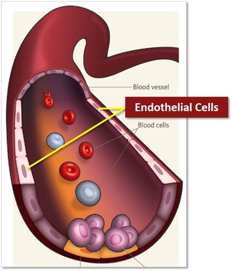 High Blood Pressure: What To Do About It – 292 - Medici Enterprises