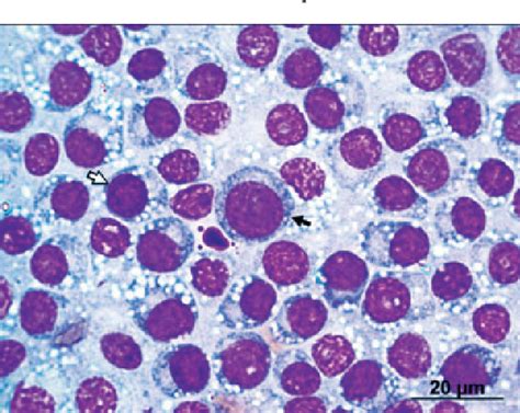 Lrctc Cytology