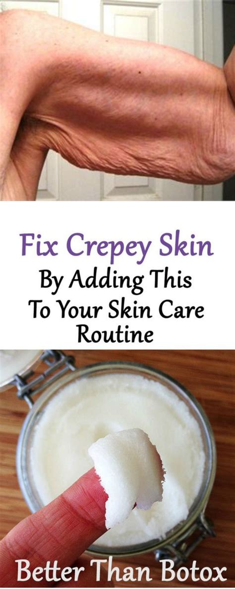 My Crepey Skin Remedies - Natural treatments to help get rid of crepey skin - Health Facts ...