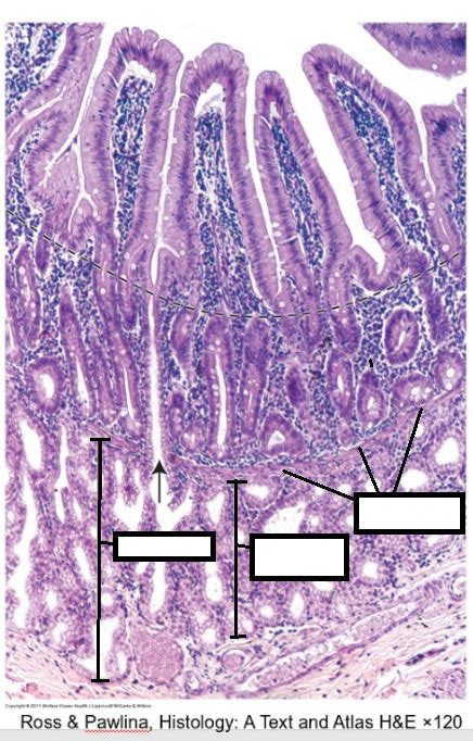 brunner's (submucosa) glands Diagram | Quizlet