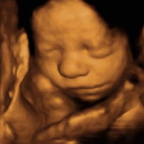 3D / 4D Ultrasound scanning at ScanSanctuary pregnancy and prenatal scanning clinic ...