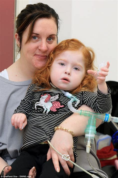 Toddler is the first person in the UK to have a pig-skin transplant | Daily Mail Online