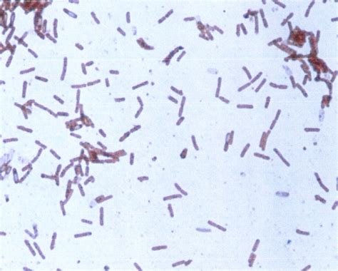 Sacrifices for the Love of Science: Bacillus spores