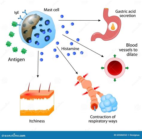 Histamine. Allergies or Allergic Diseases Stock Vector - Illustration of activation, antibody ...