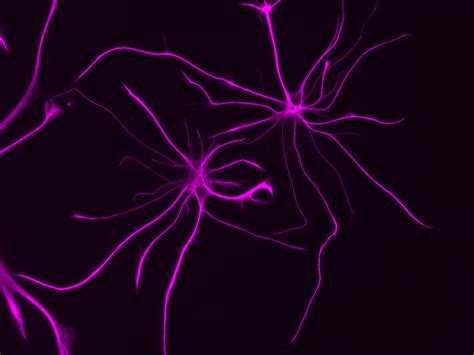 Beyond neurons: How cells called astrocytes contribute to brain disorders - Salk Institute for ...