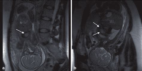 Fetal MRI, Department of Biomedical Imaging and Image-guided Therapy,... | Download Scientific ...