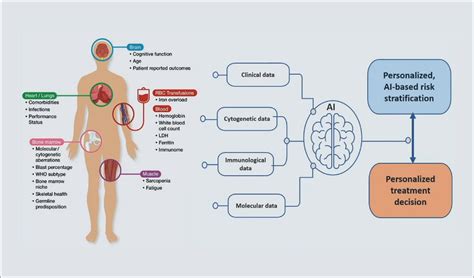 Highlights in myelodysplastic syndrome - BJH