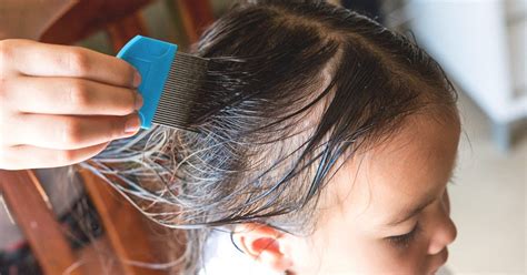 Drug-Resistant Super Lice: Symptoms, Treatment, and Prevention