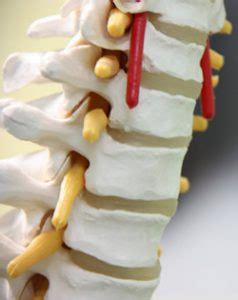 Risks of Minimally Invasive Spine Surgery - Possible Complications