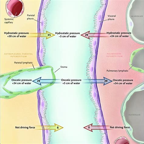 Balance of Forces Regulating Pleural Fluid Formation. The amount of ...