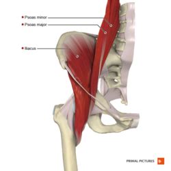 Iliopsoas Strain