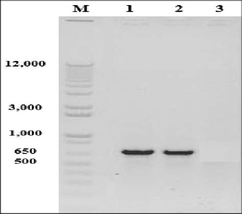 Colony PCR of the recombinant cells using EX1-C primers: M; 1kb Plus... | Download Scientific ...