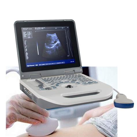 Best Portable ultrasound machines | Ultrasound, Portable, Best