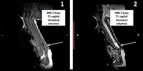 -MRI of the vertebral column MRI performed at 7-days of age. | Download Scientific Diagram