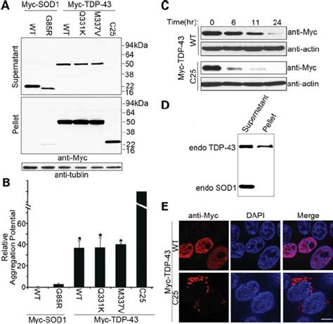 High aggregation potential of TDP-43 proteins in human cells. ( A ...