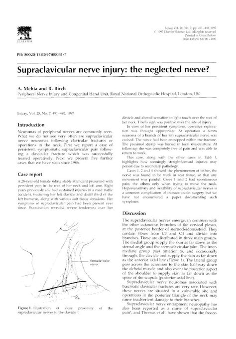 (PDF) Supraclavicular nerve injury: the neglected nerve? - DOKUMEN.TIPS