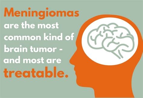 Meningioma Treatment | Johns Hopkins Medicine