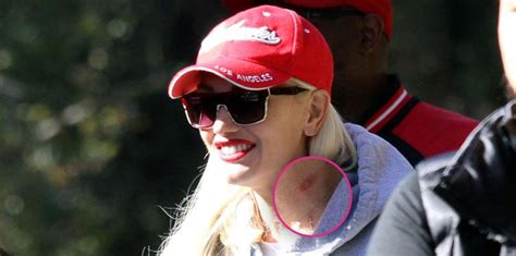 Gwen Stefani Appears To Have A Huge Hickey On Her Neck!