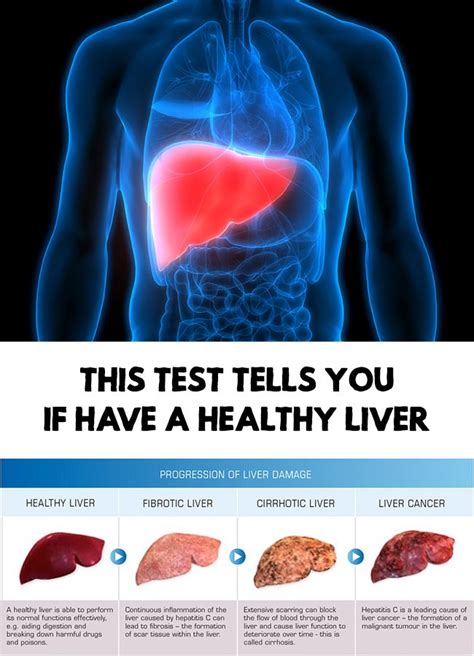 Liver test - This test tells you if have a healthy liver | Healthy ...