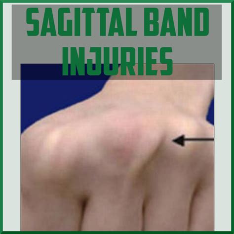 Overview on Damage to the Sagittal Bands - My Blog