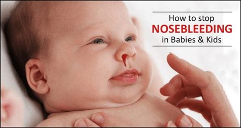 Nosebleed in Babies, why it is caused and how to control- Loving Parents