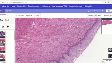 quick histology of the cervix - YouTube