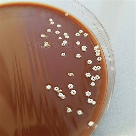 Nocardia brasiliensis. Here seen on chocolateagar. 4 days old. #nocardia #nocardiabrasiliensis # ...