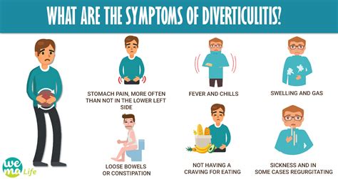 Diverticulitis: Causes, Symptoms, Treatments and Prevention