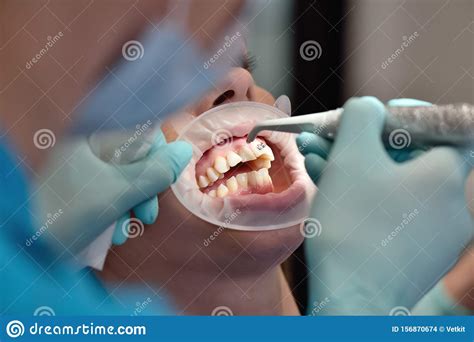 Installation Procedure of Bracket Stock Photo - Image of doctor ...