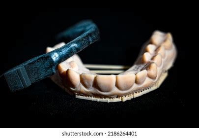 6 Mandibular Advancement Device Images, Stock Photos, and Vectors ...