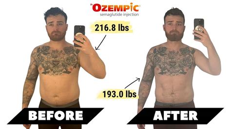 [Ozempic Before and After] I Lost More Than Just Weight: My Shocking 74-Day Journey on Ozempic