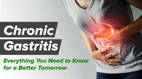 Chronic Gastritis : What Is It, Causes, Symptoms, Diagnosis, And More