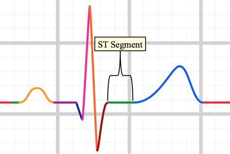 ST segment