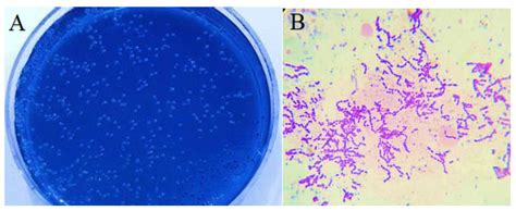 Streptococcus Mutans