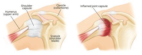 Articular Capsule Shoulder