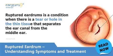 Ruptured Eardrum causes, symptoms and treatment