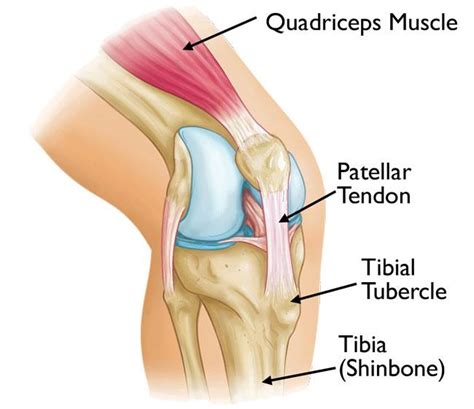 What is the bump on my knee from? Osgood-Schlatter Disease | Northwest ...