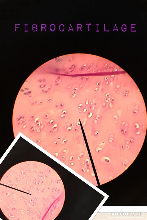 Fibrocartilage | Anatomy and physiology, Histology slides, Med student