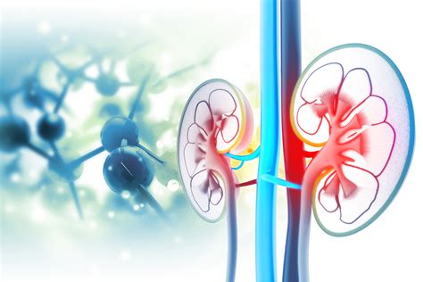 Kidney Disease: Causes | National Kidney Foundation