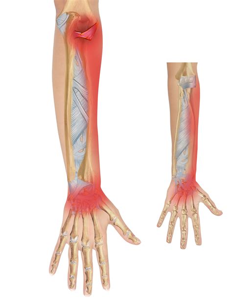 Anatomy of the Lateral Elbow Part 2