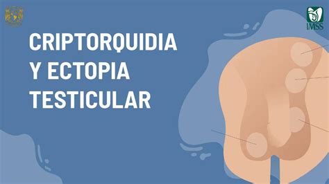 Criptorquidia y Ectopia Testicular | Jessica Aguilar | uDocz