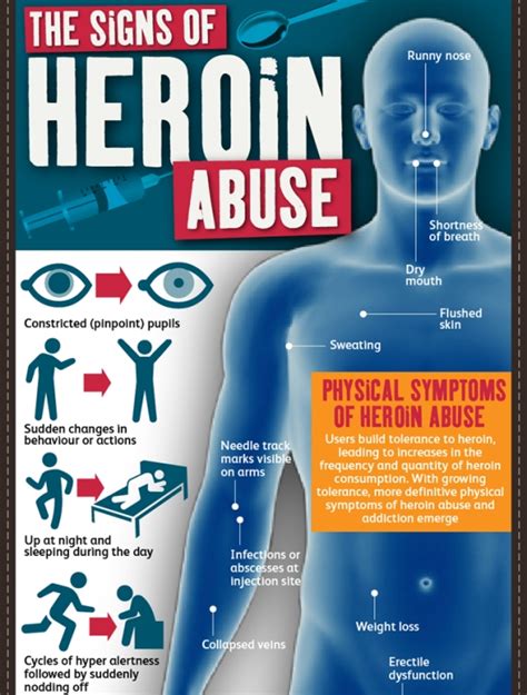 The Signs of Heroin Abuse (Infographic)