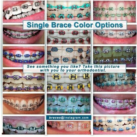 Single color braces | Braces colors, Cute braces colors, Getting braces